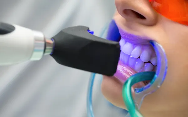 Dental Kopruler